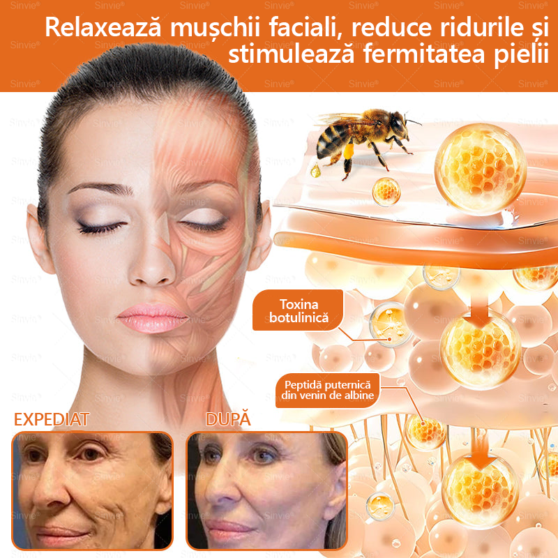 🎁🐝 Crema regeneratoare Sinvie® cu venin de albine 🔥– 50 ml🎁