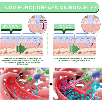 🔥🔥【Vezi rezultatele după 7 zile】🌲Voilaist® plasture nano cu microace SMGT-GLP-1 (Fără durere, cu efect de lungă durată, tratează diabetul, obezitatea și bolile cardiovasculare)