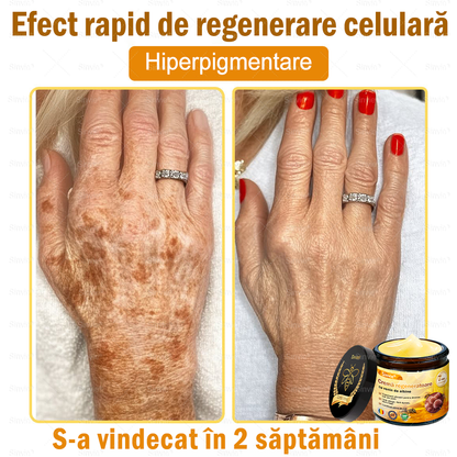 🎁🐝 Crema regeneratoare Sinvie® cu venin de albine 🔥– 50 ml🎁