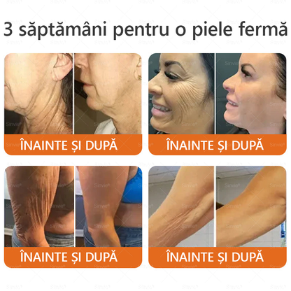 🎁🐝 Crema regeneratoare Sinvie® cu venin de albine 🔥– 50 ml🎁