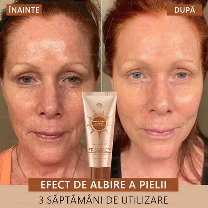 🎁FRISSARC™ masca facială  pentru albire și îndepărtarea petelor –🍀Ingredientele naturale ajută la eliminarea eficientă și de durată a petelor pigmentare, petelor de vârstă, pistruilor și petelor solare.🎁